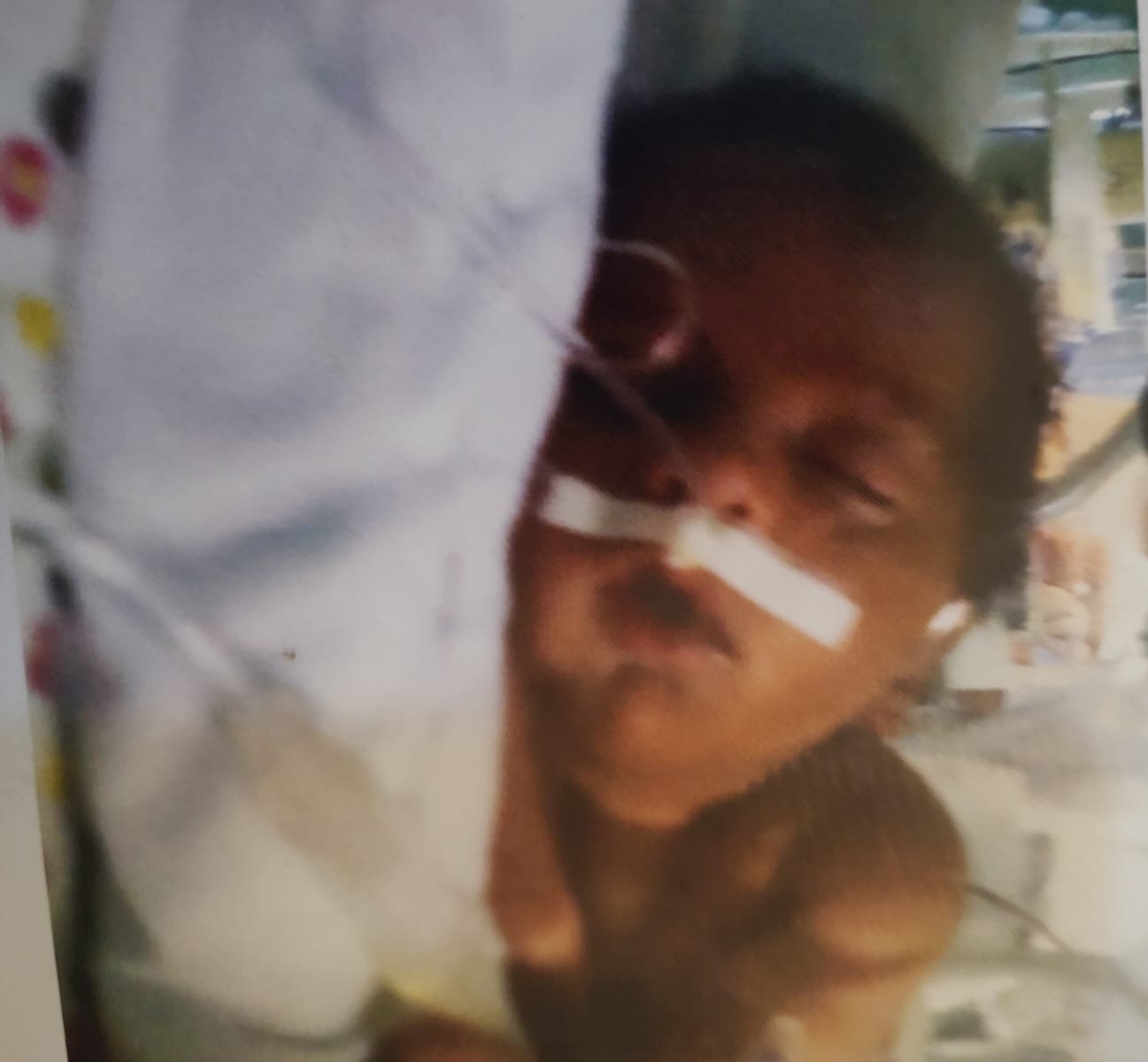 Arthur Felipe recém-nascido na UTI neonatal